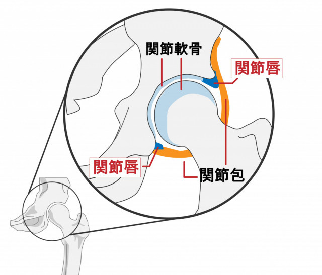 股関節の画像